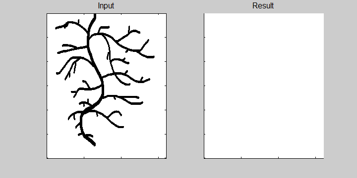 Root system